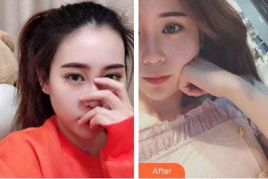 襄陽佳潔口腔醫(yī)院張利平整形價(jià)格表附牙齒隱形矯正案例展示