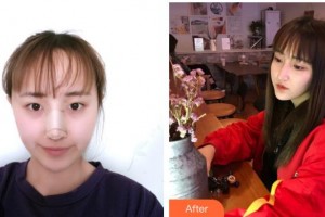 恩施華美整形美容門診部方媛整形價(jià)格表附鼻部綜合案例展示