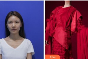 恩施慧益眼科醫(yī)院李學(xué)周整形價格表附切開雙眼皮案例展示