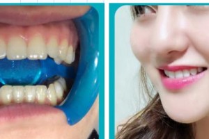 萍鄉(xiāng)龍琪口腔門診部龍琪整形價(jià)格表附冷光美白案例展示