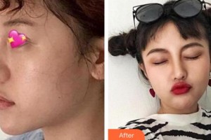 九江圣嘉麗醫(yī)療美容門診部樸濬整形價(jià)格表附鼻部綜合案例展示