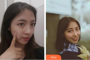 九江圣嘉麗醫(yī)療美容門診部王守文整形價(jià)格表附鼻部綜合案例展示