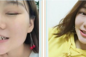 九江奇洋口腔門診部黃靜整形價格表附牙齒隱形矯正案例展示