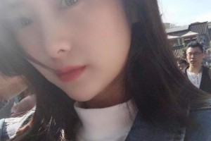 鷹潭市人民醫(yī)院眼科汪自文整形價格表附眼部綜合案例展示