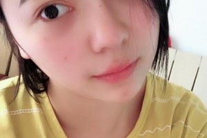 贛州亞韓醫(yī)療美容門(mén)診部金輝整形價(jià)格表附隆鼻案例展示