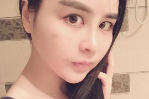 贛州明珠麗格醫(yī)療美容醫(yī)院蔣勁文整形價(jià)格表附自體脂肪填充案例展示