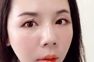 贛州衛(wèi)華口腔醫(yī)院盧衛(wèi)華整形價格表附口腔綜合案例展示