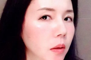 吉安康明眼科醫(yī)院張運(yùn)江整形價格表附眼部綜合案例展示