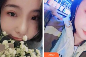 宜春韓美醫(yī)療美容門診部劉興達(dá)整形價格表附牙齒隱形矯正案例展示