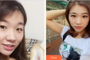 上饒平安醫(yī)院醫(yī)療美容科方五華整形價(jià)格表附眼部綜合案例展示