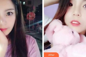 上饒維樂陽(yáng)光口腔門診部梅健整形價(jià)格表附牙齒隱形矯正案例展示