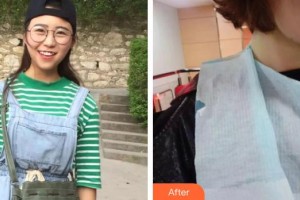 上饒維樂陽(yáng)光口腔門診部楊唐文整形價(jià)格表附牙齒陶瓷矯正案例展示