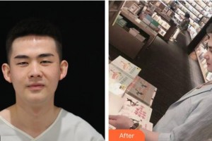 平頂山藝美醫(yī)療美容醫(yī)院張萍整形價(jià)格表附鼻部綜合案例展示