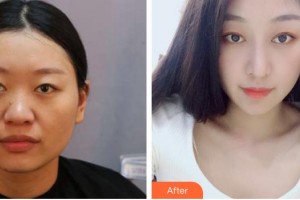 烏魯木齊時光醫(yī)療美容門診部馬龍整形價格表附鼻部綜合案例展示