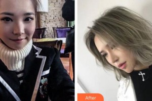 烏魯木齊黎美整形門診部王桃花整形價格表附自體軟骨墊鼻尖案例展示