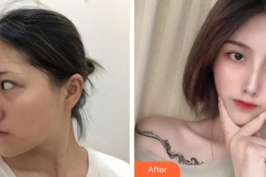 烏魯木齊王共禮醫(yī)療美容整形門診部王共禮整形價格表附鼻部綜合案例展示