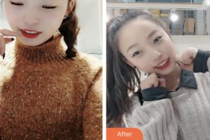 昆山杰齒口腔醫(yī)院蔣永林整形價(jià)格表附超聲波潔牙案例展示