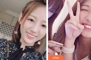 昆山杰齒口腔醫(yī)院翁雨來整形價(jià)格表附牙齒隱形矯正案例展示