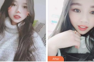 昆山拜博口腔門診部邊俊杰整形價(jià)格表附超聲波潔牙案例展示