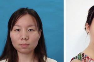 鹽城東方婦產(chǎn)醫(yī)院整形美容中心方長(zhǎng)亮整形價(jià)格表附切開雙眼皮案例展示