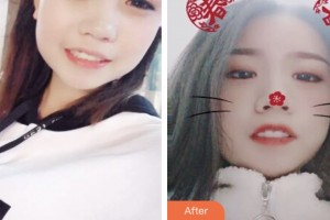 鹽城口腔醫(yī)院劉正彤整形價(jià)格表附冷光美白案例展示