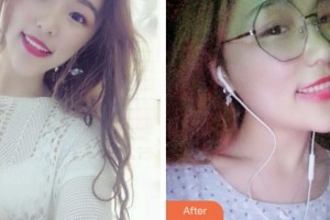 鹽城倍美永康口腔門診部高麗整形價(jià)格表附冷光美白案例展示