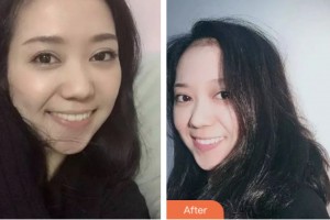 鹽城倍美永康口腔門診部呂利松整形價(jià)格表附牙齒隱形矯正案例展示