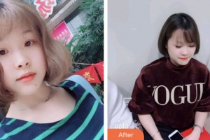 淮安諾貝爾口腔醫(yī)院張玉峰整形價格表附美白貼片案例展示