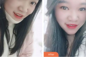 淮安城際口腔醫(yī)院劉永平整形價格表附超聲波潔牙案例展示