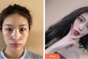 婁底德美醫(yī)療整形美容診所陳貴南整形價格表附眼部綜合案例展示