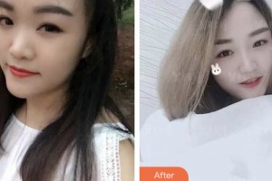 婁底德美醫(yī)療整形美容診所董林先整形價格表附鼻部綜合案例展示