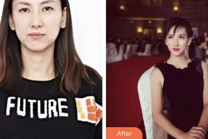 荊門市第一人民醫(yī)院醫(yī)學(xué)美容中心李薇薇整形價(jià)格表附超聲提拉案例展示