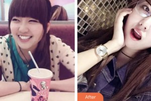 荊門小白兔口腔醫(yī)院杜耿整形價格表附金屬托槽矯正案例展示