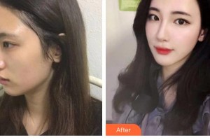 泰州麗都醫(yī)療美容醫(yī)院李麗杰整形價格表附鼻部綜合案例展示