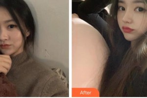 泰州麗都醫(yī)療美容醫(yī)院周入仁整形價格表附鼻部綜合例展示