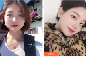 泰州麗都醫(yī)療美容醫(yī)院許俊平整形價格表附耳軟骨復合隆鼻案例展示