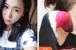 鎮(zhèn)江采薇整形美容醫(yī)院高思遠(yuǎn)整形價(jià)格表附鼻中隔軟骨隆鼻案例展示