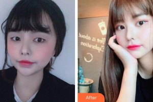 湘潭市中心醫(yī)院醫(yī)學(xué)整形美容科周牡丹整形價格表附眼部綜合案例展示