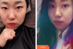 永州新唯美整形美容醫(yī)院安棟顯整形價格表附眼部修復(fù)案例展示