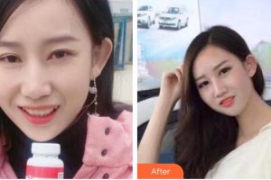 永州國(guó)斌口腔門(mén)診部唐穎文整形價(jià)格表附牙齒隱形矯正案例展示