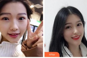 永州牙博士口腔醫(yī)院曾憲華整形價格表附牙齒隱形矯正案例展示