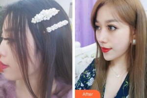 天水瑪莉亞（原女子）醫(yī)院醫(yī)學(xué)整形中心傅天祥整形價(jià)格表附鼻部綜合案例展示