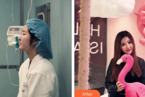 天水瑪莉亞（原女子）醫(yī)院醫(yī)學(xué)整形中心李曉愛整形價(jià)格表附鼻部綜合案例展示