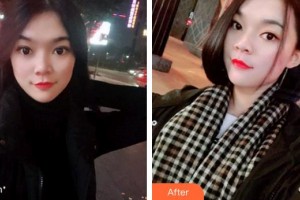 天水瑪莉亞（原女子）醫(yī)院醫(yī)學(xué)整形中心石正平整形價(jià)格表附牙齒隱形矯正案例展示