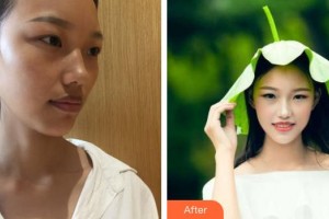 銀川愛美麗醫(yī)療美容門診部秦宏治整形價(jià)格表附射頻緊膚案例展示