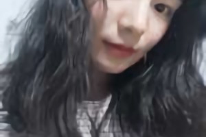 北京圣嘉榮醫(yī)療美容醫(yī)院磨骨好不好？附黃大勇磨骨案例