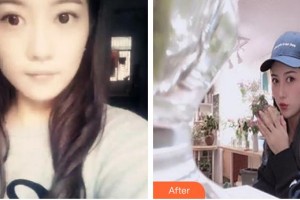 中國(guó)人民解放軍251醫(yī)院整形美容科張瑾整形價(jià)格表附假體隆鼻案例展示