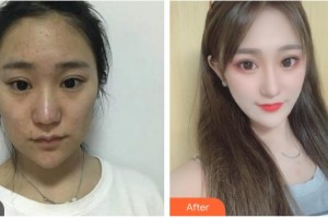 解放軍105醫(yī)院整形美容中心衛(wèi)俠整形價(jià)格表附激光美膚激光案例展示