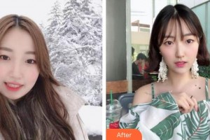 解放軍105醫(yī)院整形美容中心陶琳整形價(jià)格表附埋線提升案例展示