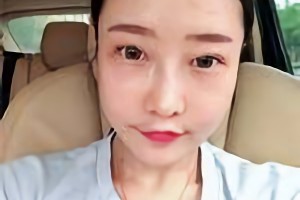 華西口腔醫(yī)院李運峰磨骨手術價格貴嗎？附價格表和案例